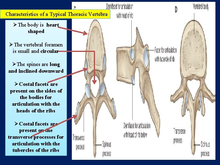 Characteristics of a Typical Thoracic Vertebra ØThe body is heart shaped ØThe vertebral foramen