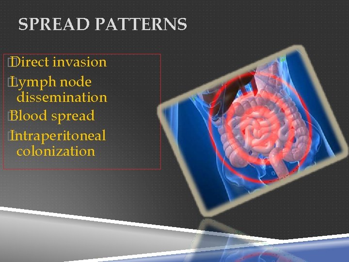 SPREAD PATTERNS � Direct invasion � Lymph node dissemination � Blood spread � Intraperitoneal
