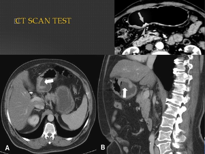 � CT SCAN TEST 