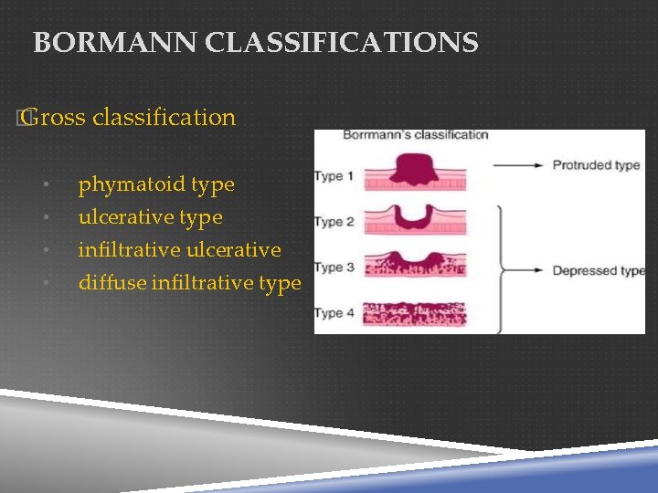 BORMANN CLASSIFICATIONS � Gross classification • • phymatoid type ulcerative type infiltrative ulcerative diffuse