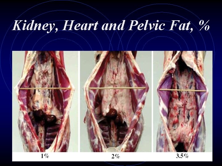Kidney, Heart and Pelvic Fat, % 