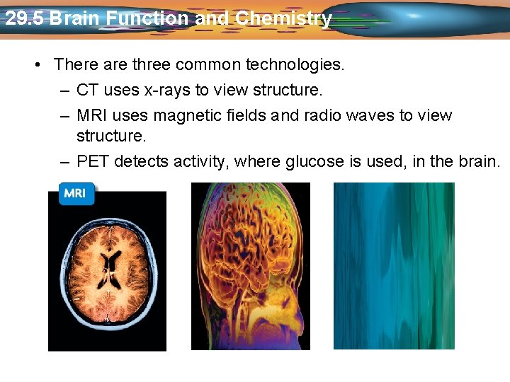 29. 5 Brain Function and Chemistry • There are three common technologies. – CT
