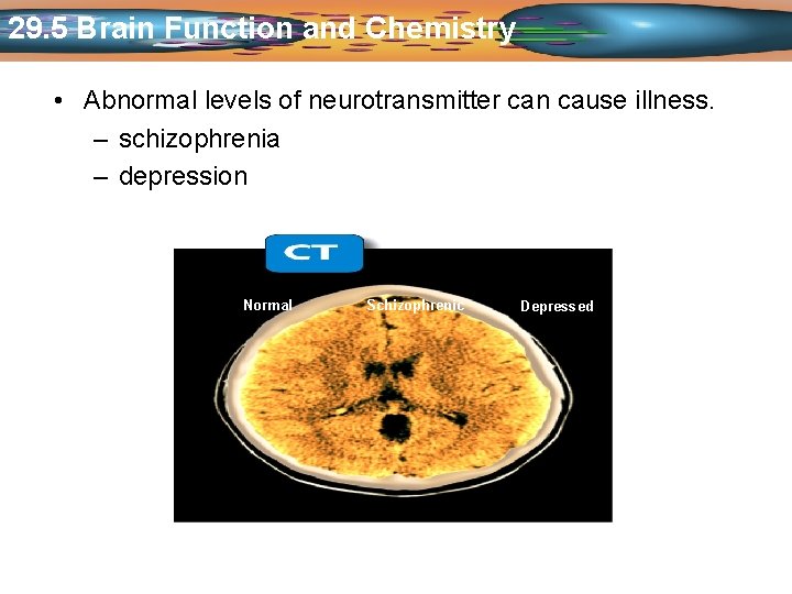 29. 5 Brain Function and Chemistry • Abnormal levels of neurotransmitter can cause illness.