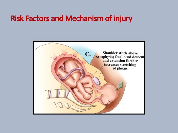 Risk Factors and Mechanism of injury 