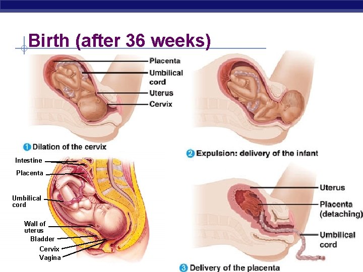 Birth (after 36 weeks) Intestine Placenta Umbilical cord Wall of uterus Bladder AP Cervix