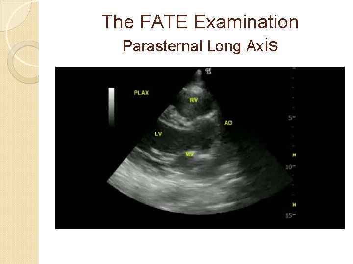 The FATE Examination Parasternal Long Axis 