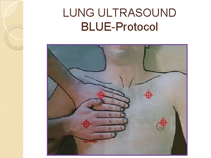LUNG ULTRASOUND BLUE-Protocol 