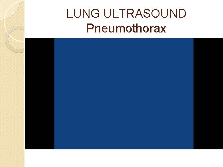 LUNG ULTRASOUND Pneumothorax 