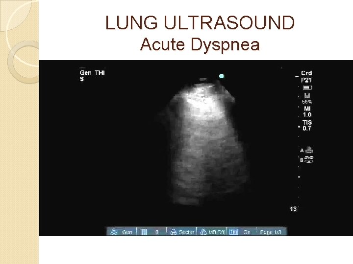 LUNG ULTRASOUND Acute Dyspnea 