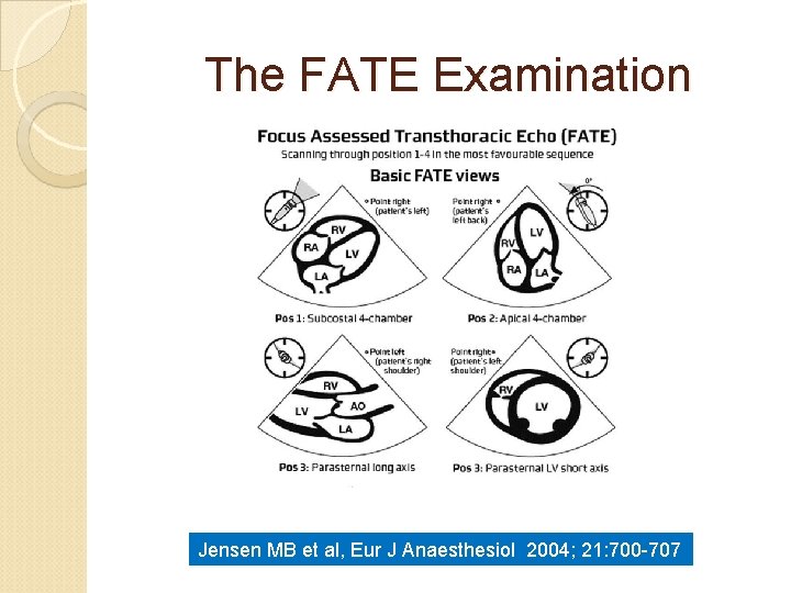 The FATE Examination Jensen MB et al, Eur J Anaesthesiol 2004; 21: 700 -707