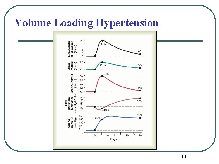 Volume Loading Hypertension 19 Volume Loading Hypertension 19