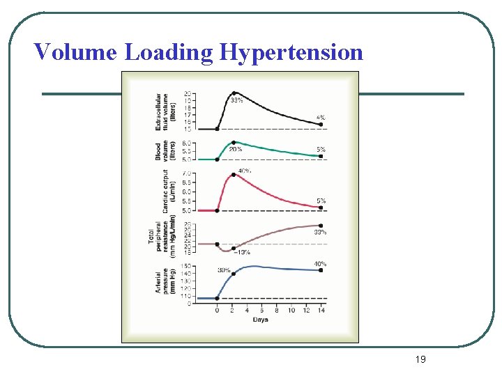 Volume Loading Hypertension 19 