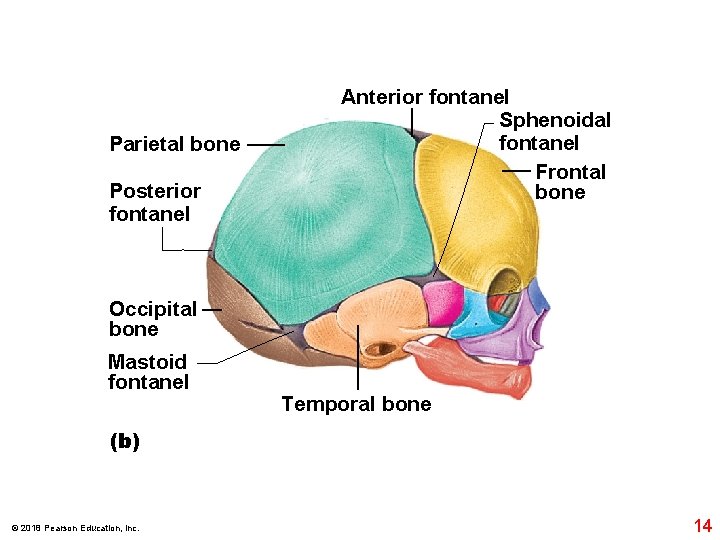 Parietal bone Posterior fontanel Anterior fontanel Sphenoidal fontanel Frontal bone Occipital bone Mastoid fontanel