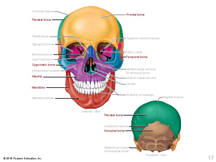 Coronal suture Frontal bone Parietal bone Nasal bone Superior orbital fissure Sphenoid bone Optic