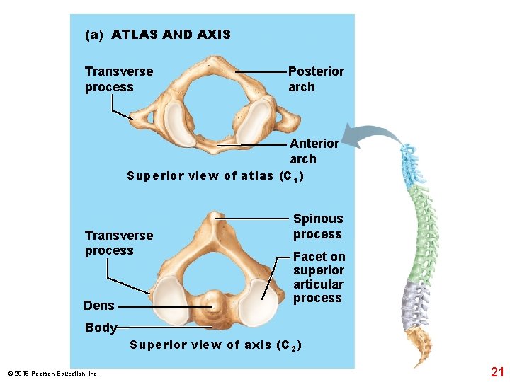 (a) ATLAS AND AXIS Transverse process Posterior arch Anterior arch Superior view of atlas
