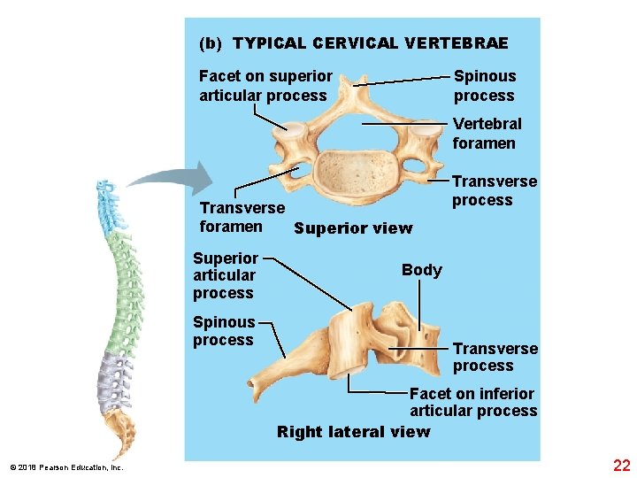 (b) TYPICAL CERVICAL VERTEBRAE Facet on superior articular process Spinous process Vertebral foramen Transverse