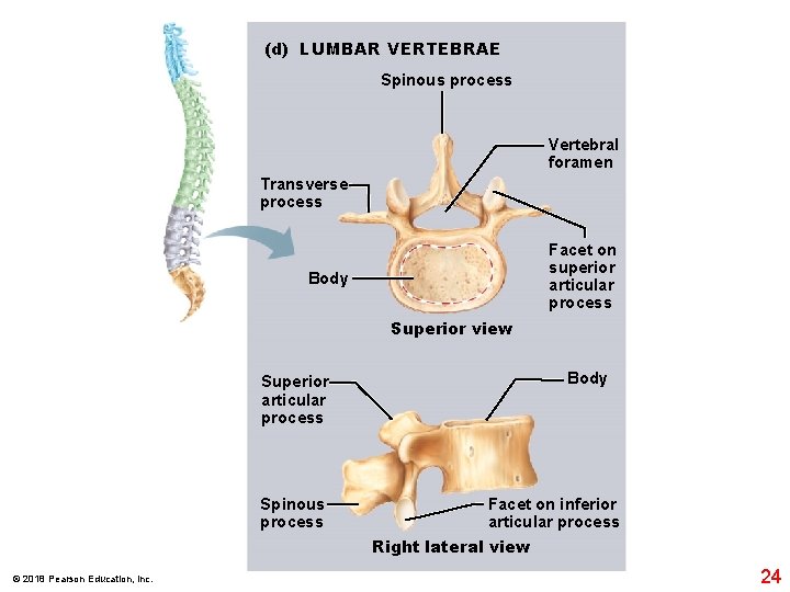 (d) LUMBAR VERTEBRAE Spinous process Vertebral foramen Transverse process Facet on superior articular process