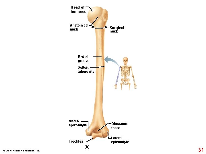 Head of humerus Anatomical neck Surgical neck Radial groove Deltoid tuberosity Medial epicondyle Lateral