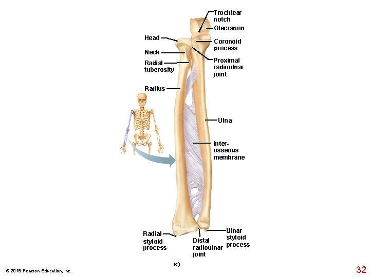 Trochlear notch Olecranon Head Coronoid process Neck Radial tuberosity Proximal radioulnar joint Radius Ulna