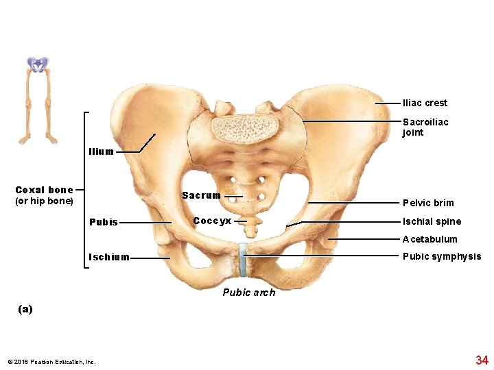 Iliac crest Sacroiliac joint llium Coxal bone (or hip bone) Sacrum Pubis Pelvic brim