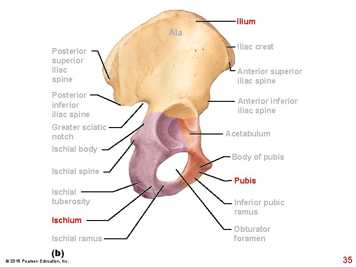 Ilium Ala Posterior superior i. Iiac spine Posterior inferior i. Iiac spine Greater sciatic