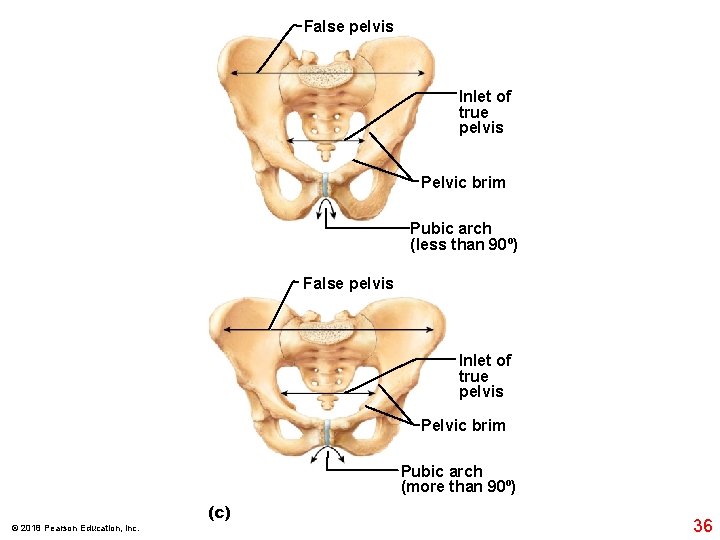 False pelvis Inlet of true pelvis Pelvic brim Pubic arch (less than 90º) False