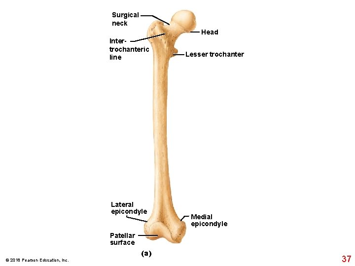Surgical neck Head Intertrochanteric line Lateral epicondyle Lesser trochanter Medial epicondyle Patellar surface (a)