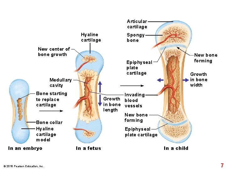 Articular cartilage Hyaline cartilage Spongy bone New center of bone growth New bone forming