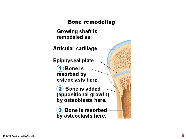 Bone remodeling Growing shaft is remodeled as: Articular cartilage Epiphyseal plate 1 Bone is