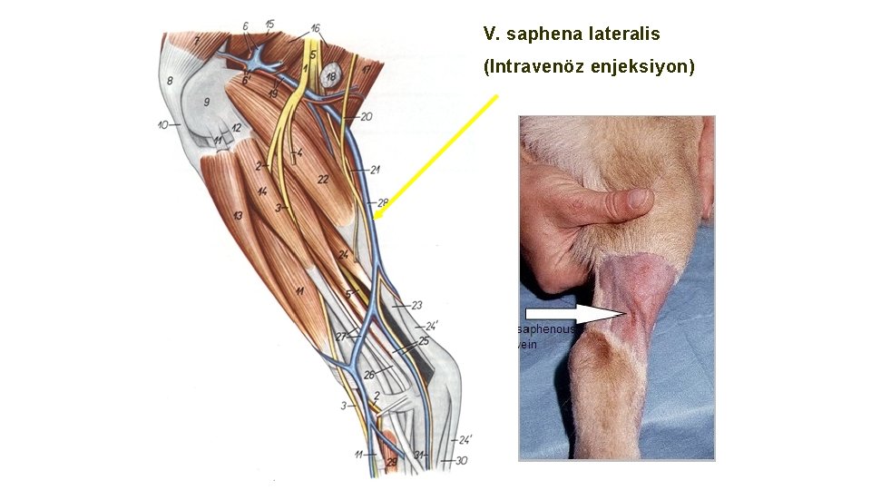 V. saphena lateralis (Intravenöz enjeksiyon) 