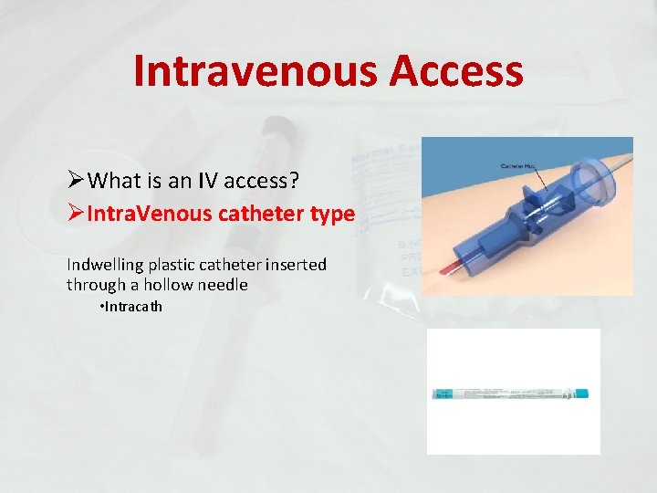 Intravenous Access ØWhat is an IV access? ØIntra. Venous catheter type Indwelling plastic catheter