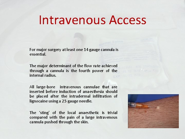 Intravenous Access For major surgery at least one 14 gauge cannula is essential. The