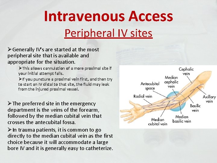 Intravenous Access Peripheral IV sites ØGenerally IV's are started at the most peripheral site