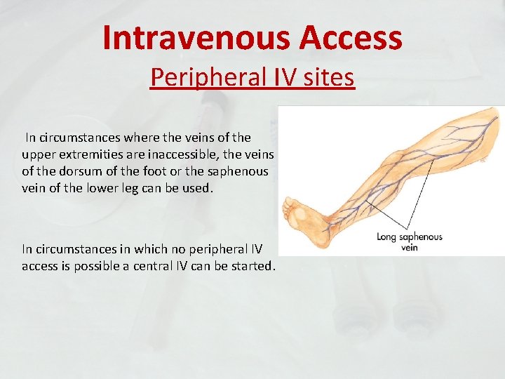 Intravenous Access Peripheral IV sites In circumstances where the veins of the upper extremities