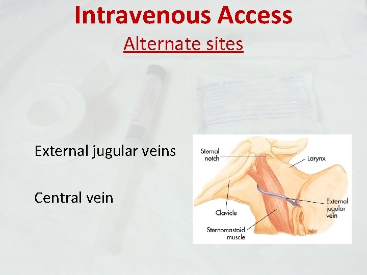 Intravenous Access Alternate sites External jugular veins Central vein 