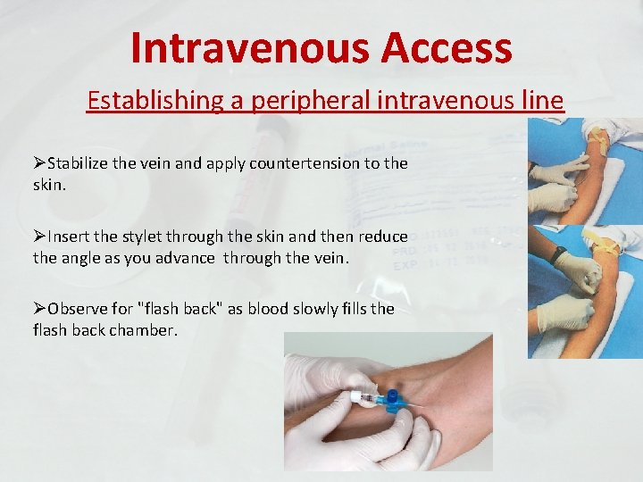 Intravenous Access Establishing a peripheral intravenous line ØStabilize the vein and apply countertension to