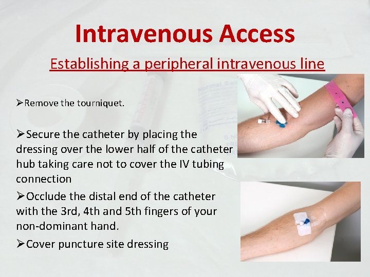 Intravenous Access Establishing a peripheral intravenous line ØRemove the tourniquet. ØSecure the catheter by