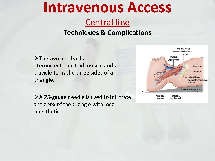 Intravenous Access Central line Techniques & Complications ØThe two heads of the sternocleidomastoid muscle