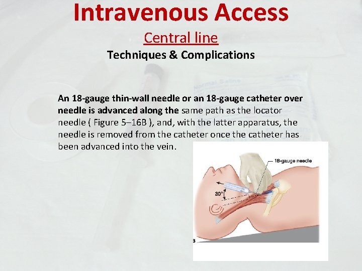Intravenous Access Central line Techniques & Complications An 18 -gauge thin-wall needle or an