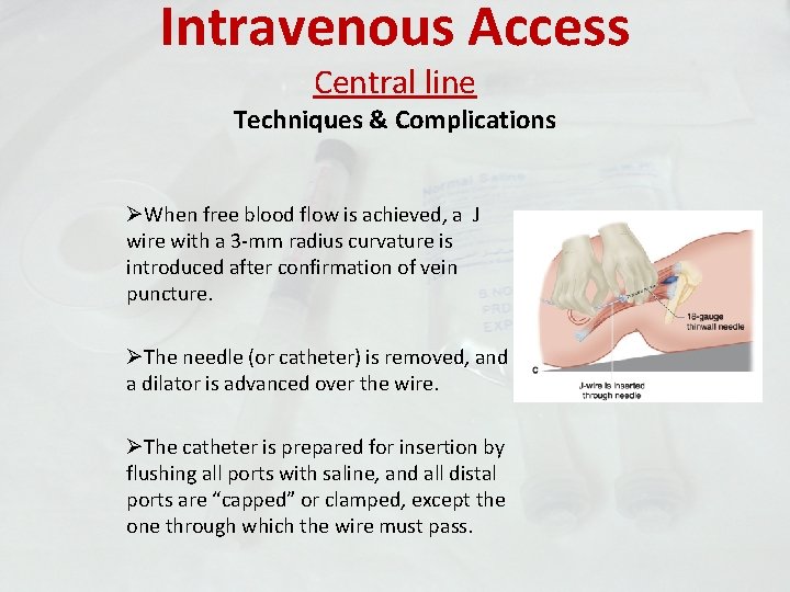 Intravenous Access Central line Techniques & Complications ØWhen free blood flow is achieved, a