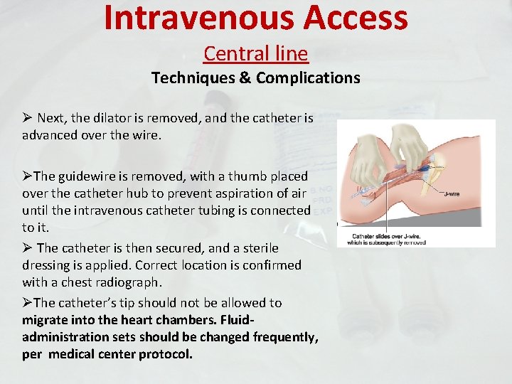 Intravenous Access Central line Techniques & Complications Ø Next, the dilator is removed, and