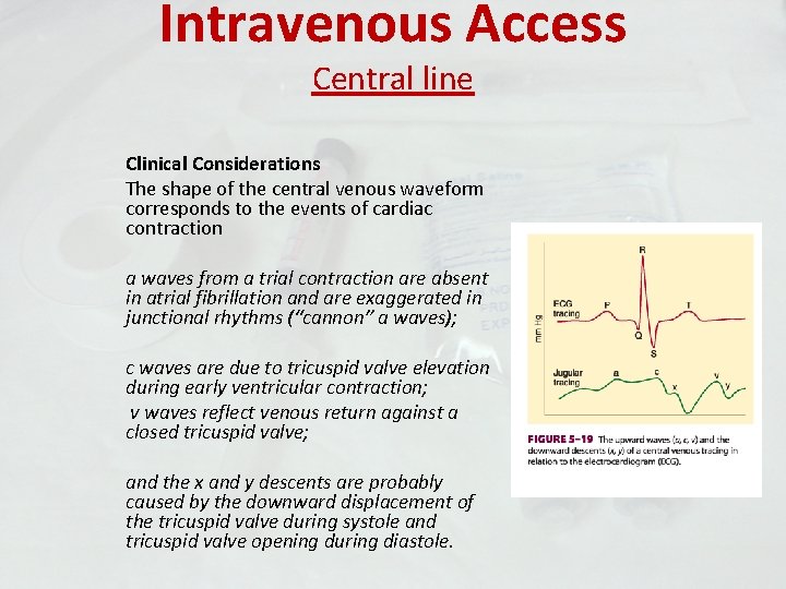 Intravenous Access Central line Clinical Considerations The shape of the central venous waveform corresponds