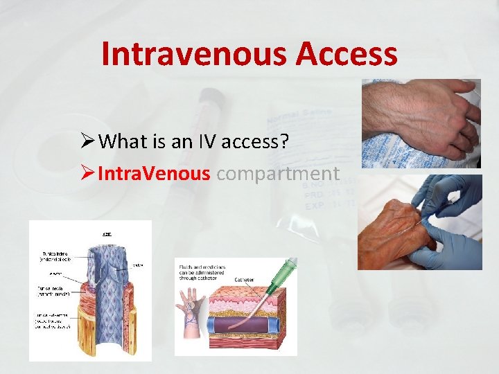 Intravenous Access ØWhat is an IV access? ØIntra. Venous compartment 