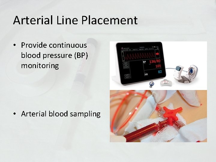 Arterial Line Placement • Provide continuous blood pressure (BP) monitoring • Arterial blood sampling