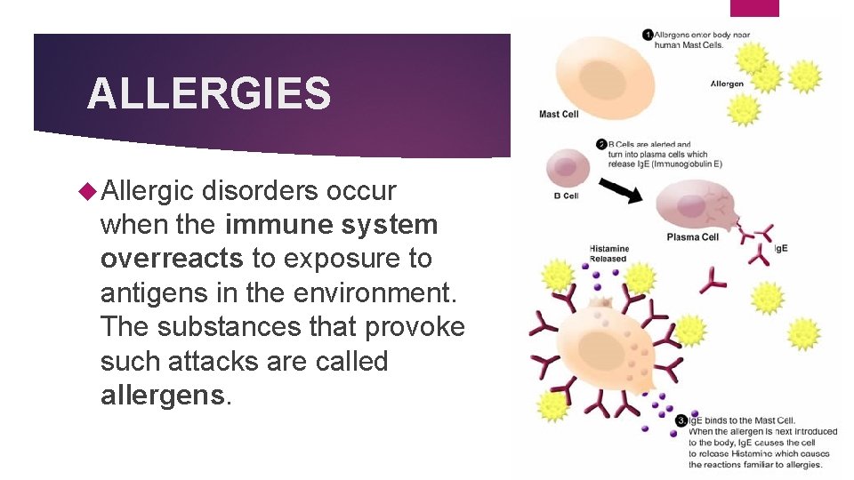 ALLERGIES Allergic disorders occur when the immune system overreacts to exposure to antigens in