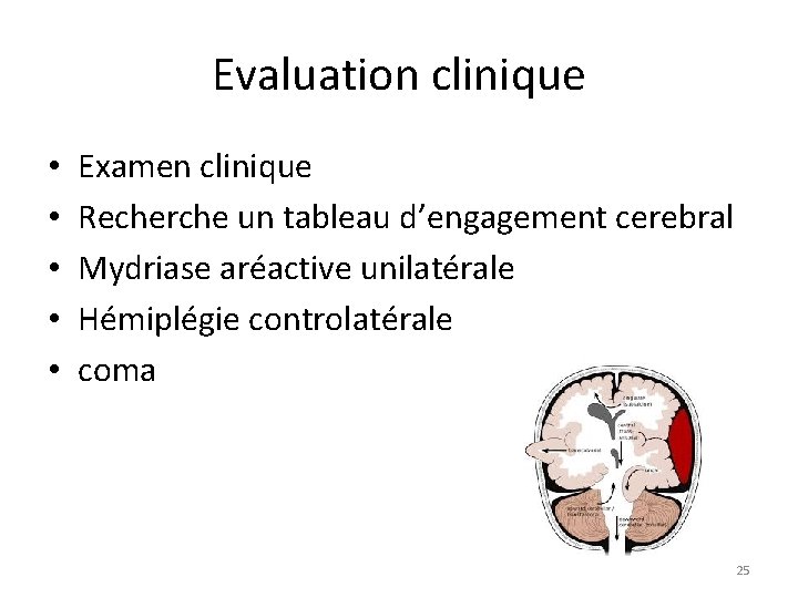 Evaluation clinique • • • Examen clinique Recherche un tableau d’engagement cerebral Mydriase aréactive