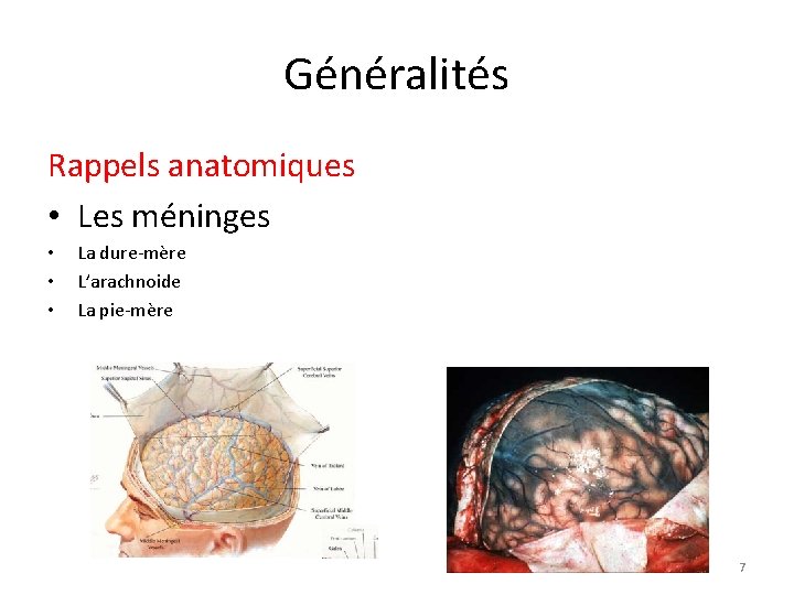 Généralités Rappels anatomiques • Les méninges • • • La dure-mère L’arachnoide La pie-mère