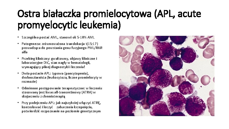 Ostra białaczka promielocytowa (APL, acute promyelocytic leukemia) • Szczególna postać AML, stanowi ok 5