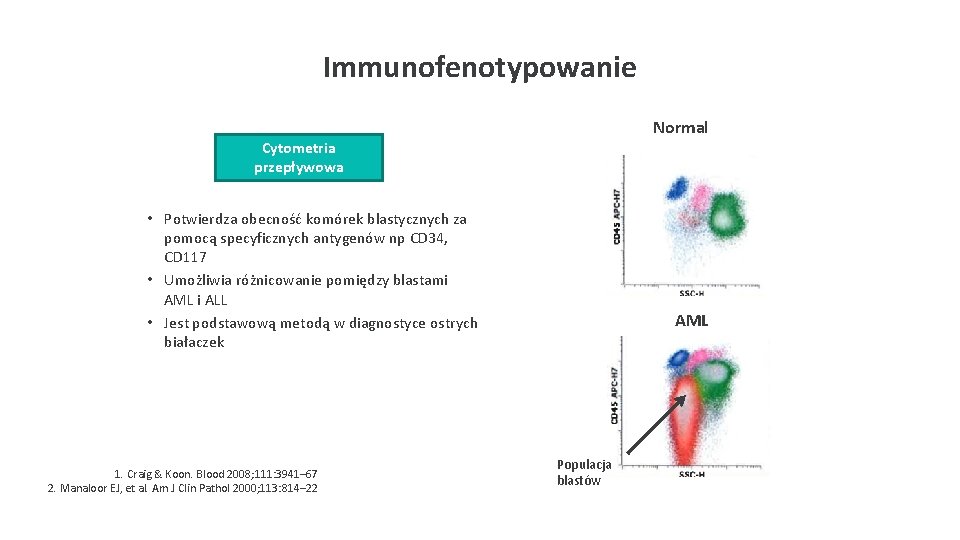 Immunofenotypowanie Normal Cytometria przepływowa • Potwierdza obecność komórek blastycznych za pomocą specyficznych antygenów np