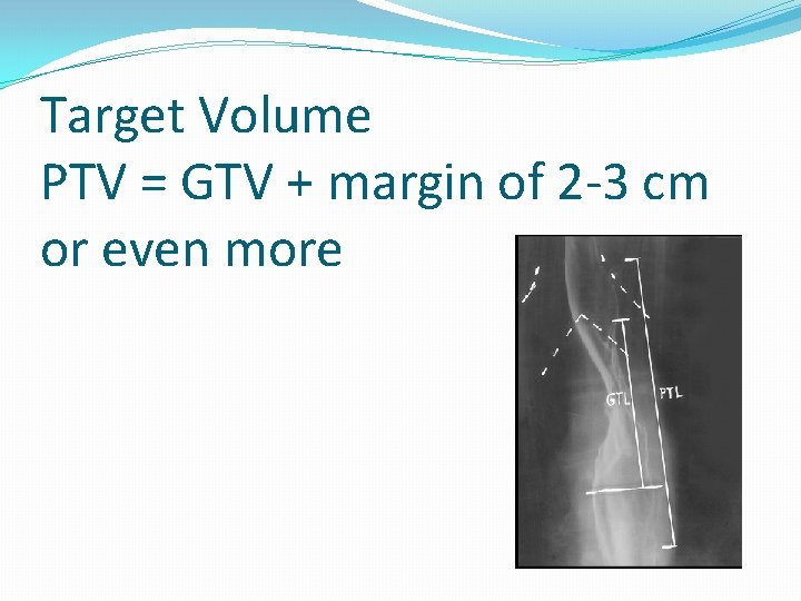 Target Volume PTV = GTV + margin of 2 -3 cm or even more